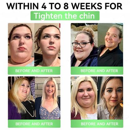 Official Store| Alcuras™ Moringa × Berberine × AMPK 8-Benefit Slimming & Metabolic Nano Microneedle Patch 🇺🇸  Just once a day · Visible changes in 7 days  ✅ For obesity, loose skin, diabetes, sleep apnea, joint issues, and more  moringa patches